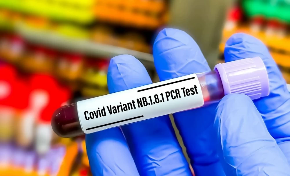 Covid-19 : NB.1.8.1, nouveau variant sous surveillance par l’OMS