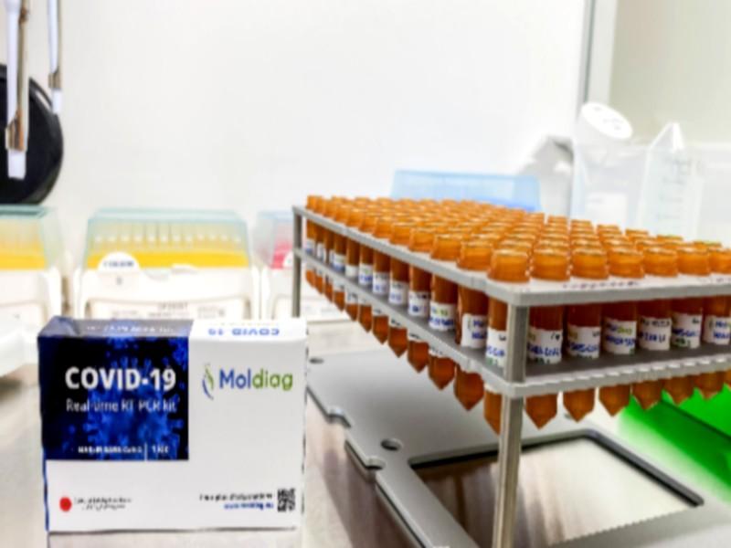 Lancement de la production à grande échelle du test PCR 100% marocain